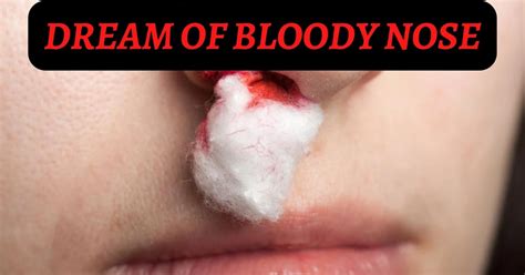 The Symbolism of a Bloody Nose in a Dream